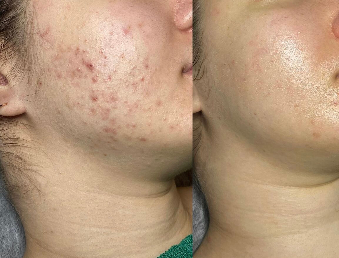 pHformula hooldused – Skincare